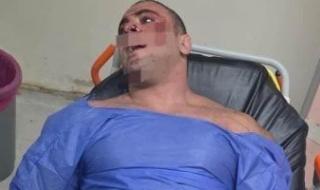 حبس
المتهم
بإصابة
مدير
صالة
جيم
بطلق
نارى
فى
الشيخ
زايد
4
أيام