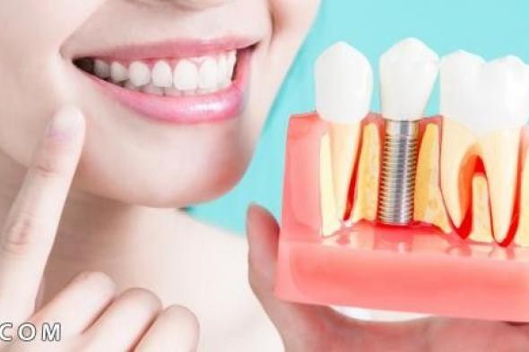 تركيب الاسنان | أسهل طريقة لـ تركيب الاسنان الثابتة