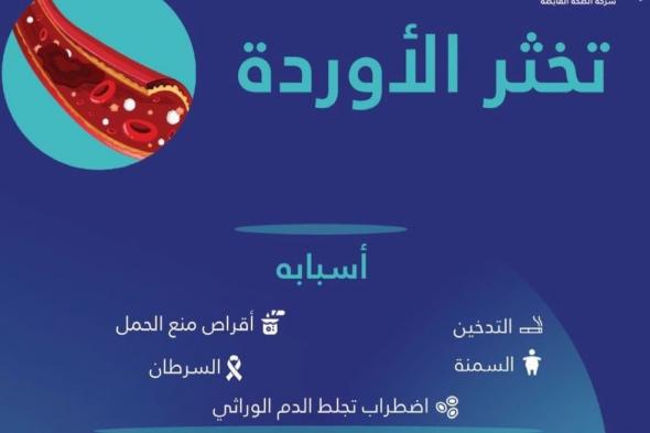 أقراص منع الحمل.. أسباب "تخثر الأوردة" والوقاية والعلاج في إيضاح لـ"فهد الطبية"