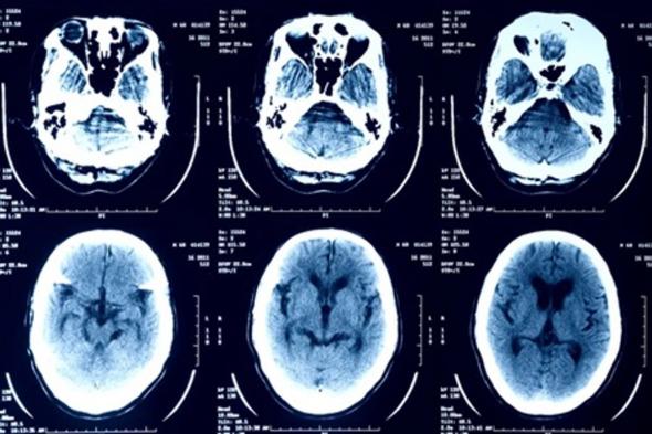 تقرير تقني يحذّر.. لا تحمّل صور أشعتك الطبية إلى روبوتات الدردشة بالذكاء الاصطناعي