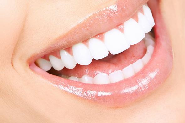 أخصائي: ربط ابتسامة هوليود بالتركيبات والعدسات مفهوم خاطيء