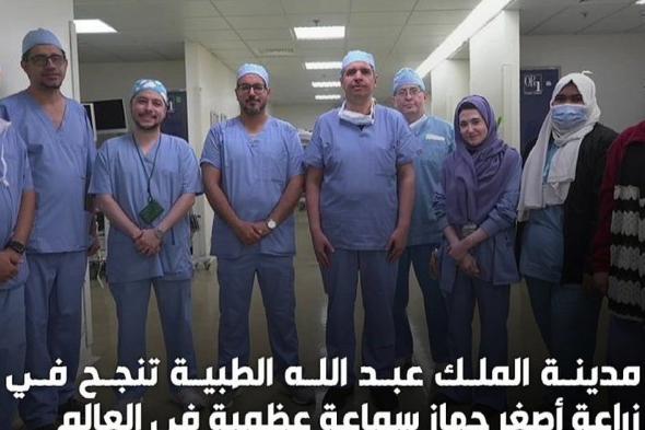 إنجاز طبي غير مسبوق في المملكة والشرق الأوسط: زراعة أصغر سماعة عظمية لعشرينية بمكة