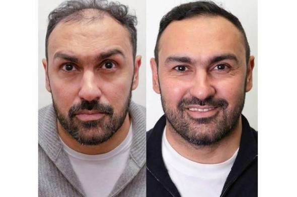 المصري أحمد المحمدي صغّر سنه 5 سنوات