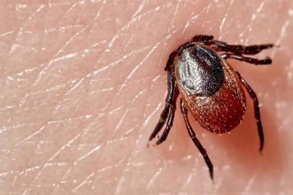 تحذير طبي في أمريكا: وفاة أول شخص بسبب حساسية اللحوم بعد لسعة قراد