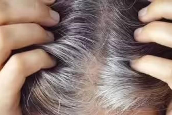 وداعاً للشيب.. اكتشاف إنزيم جديد يفتح الباب لعودة لون الشعر طبيعياً