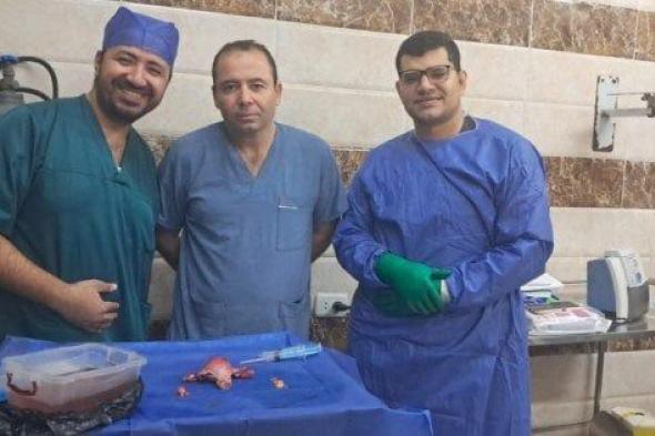 مستشفيات جامعة بني سويف تحقق نجاحًا بارزًا في جراحة تحديد مراحل ورم بطانة الرحم