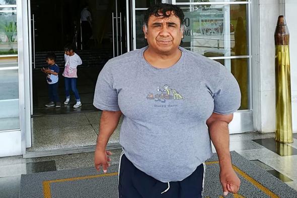 حادث غطس يتسبب بحالة تشوه نادرة لغواص والطب لا يجد حلا