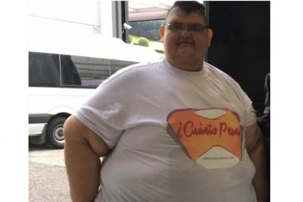 عدوى
      في
      الكلى
      تنهي
      حياة
      «أسمن
      رجل»
      عن
      41
      عاماً