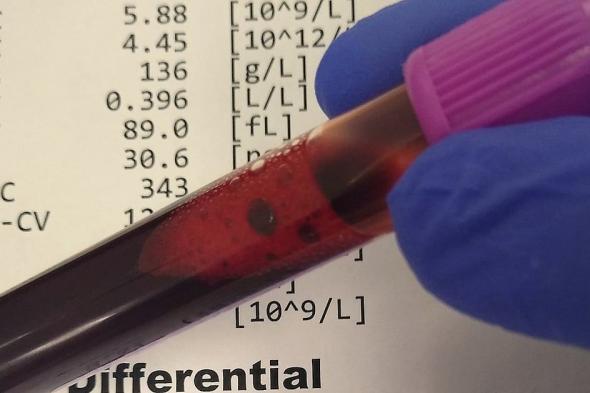 "النمر"
    يحذر
    من
    وهم
    شائع:
    تحاليل
    السيولة
    لا
    تمنع
    الجلطات
    ولا
    تُطلب
    للاطمئنان