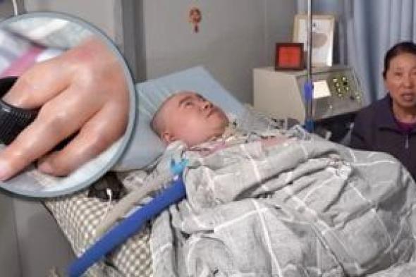 صينى
مشلول
يؤسس
نظام
مزرعة
ذكية
وشركة
ناشئة
بإصبعى
يد
وقدم