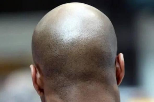 هندية
      تشتكي
      زوجها
      لإخفائه
      صلعه