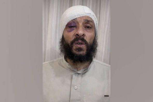 من
      الغربة
      إلى
      الجلطة..
      تفاصيل
      صراع
      على
      50
      مليون
      جنيه
      يمزق
      أسرة
      طبيب
      مصري