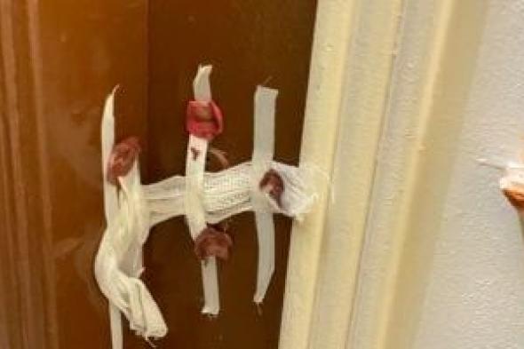 ضبط
طالبة
تنتحل
صفة
طبيبة
جلدية
وتدير
مركز
تجميل
وهمي
بسوهاج