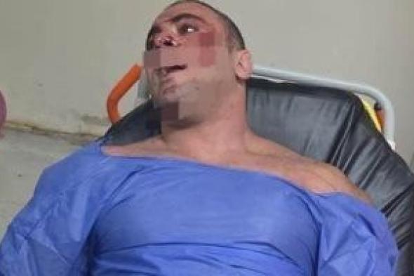 النيابة
تطالب
بسرعة
إرسال
تقرير
فحص
كاميرات
الجيم
بإطلاق
النار
على
"الديزل"