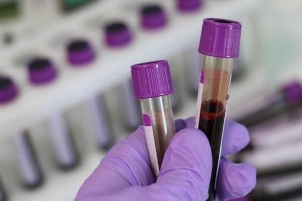 اختبار
      دم
      ذكي
      يكشف
      سرطان
      البروستاتا
      بدقة
      عالية