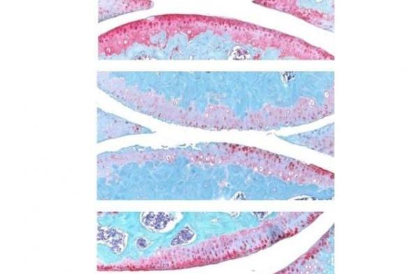 وداعاً
      لعمليات
      التغيير..
      الكشف
      عن
      دواء
      سحري
      يمنح
      الغضاريف
      فرصة
      ثانية
      للتجدد
      تلقائياً