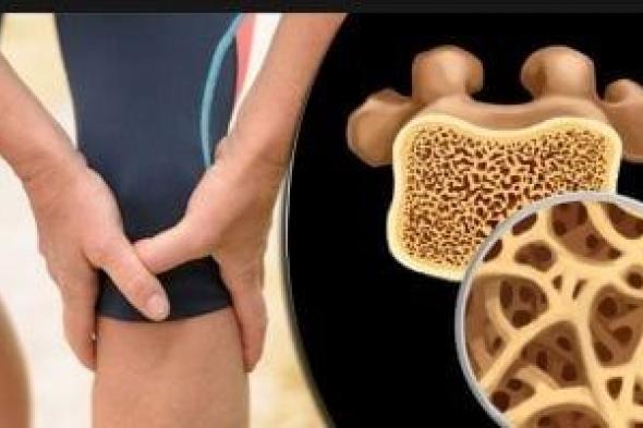 الكالسيوم
مقابل
فيتامين
د..
أيهما
أفضل
لصحة
العظام؟