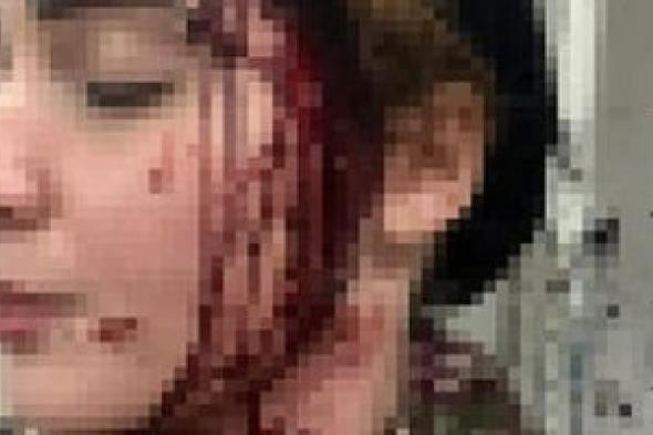 ضحية
تشويه
وجهها
بالعجوزة:
المتهم
كان
يمارس
البلطجة
ووجهت
له
تهمة
استعراض
القوة