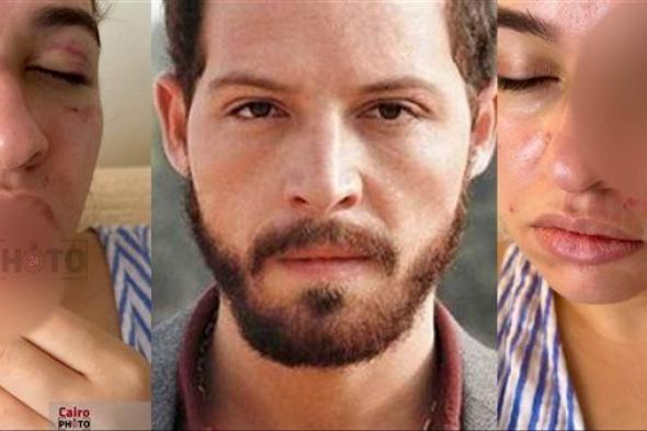 الفنان
      محمود
      حجازي
      يطالب
      جهات
      التحقيق
      بمنع
      النشر
      في
      قضية
      خلافاته
      مع
      زوجته