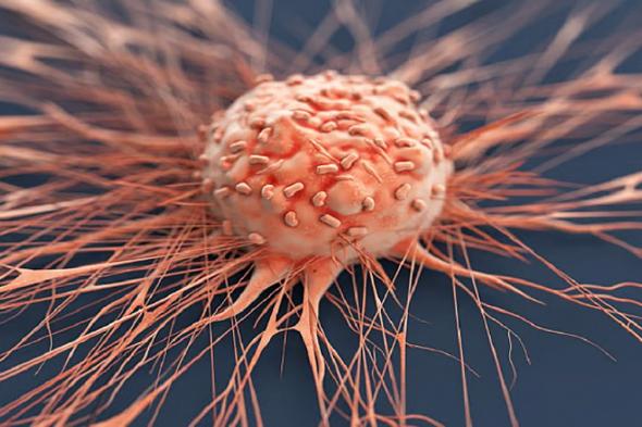 أخصائي
    أورام:
    ثلث
    الأورام
    الخبيثة
    يرتبط
    بزيادة
    الوزن