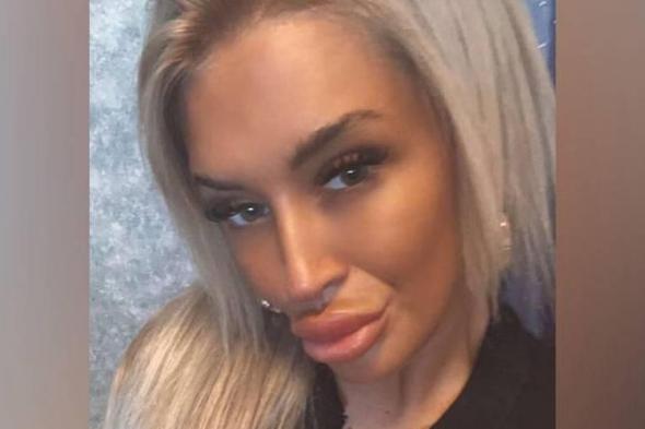 بسبب
      هوسها
      بحقن
      البوتوكس..
      بريطانية
      تهرب
      المخدرات