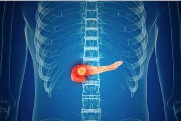 استشاري:
    4
    أعراض
    لمشكلات
    البنكرياس
    في
    الجسم